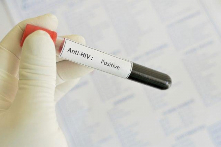 Naučnici prvi put izliječili miševe od HIV-a