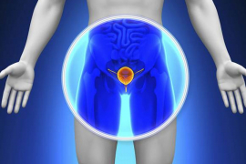 Rezultati novog istraživanja olakšaće liječenja raka prostate