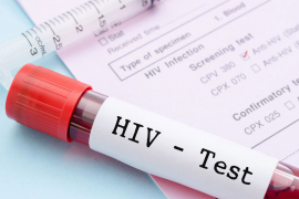 U RS registrovano 113 lica zaraženih HIV-om, 6 prijavljeno ove godine
