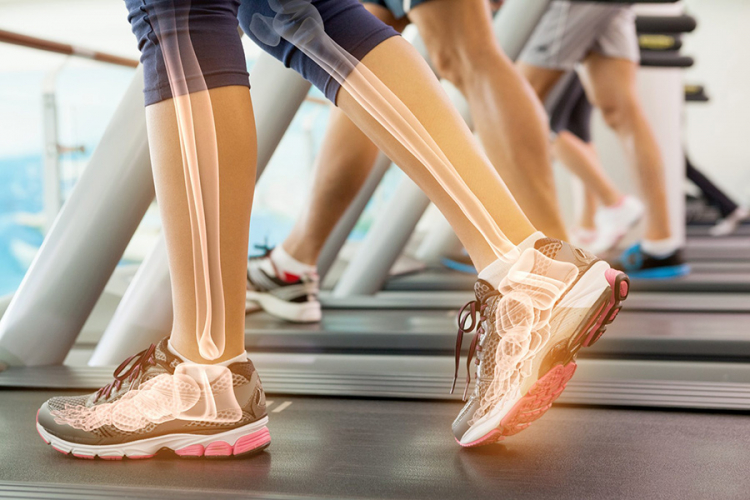 Osteoporoza: Kada kosti pucaju kao staklo