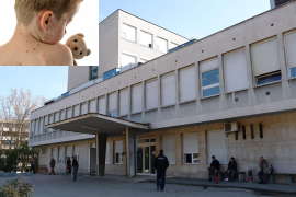 Strah od morbila i gripa skratio posjete