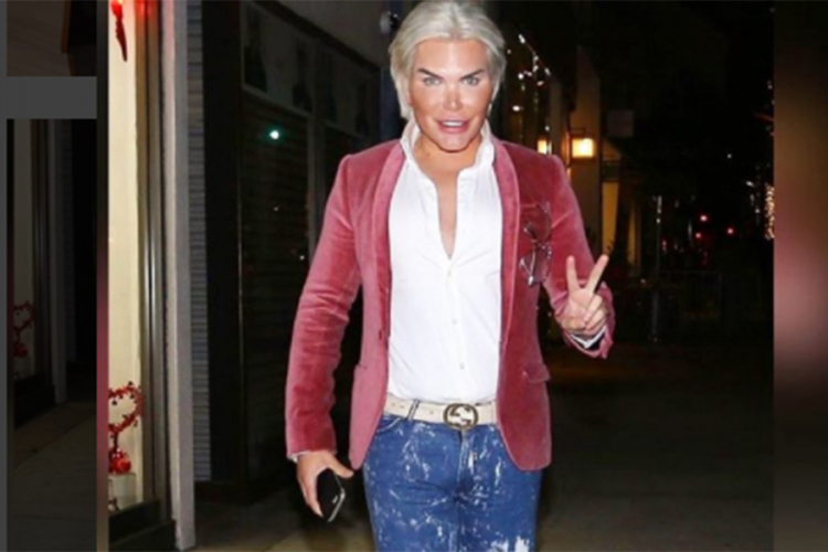 Rodrigo Alves, poznatiji kao 'Ken' završio sa estetskim zahvatima