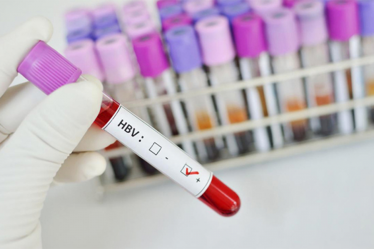 Najrašireniji virus modernog svijeta postojao i u kamenom dobu