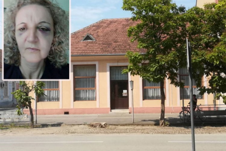 Mladoženjinu tetku pretukli svatovi