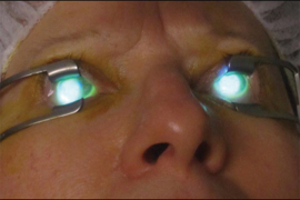 Prvi put izveden "Corneal colagen cross linking" zahvat u RS, dječaku ...