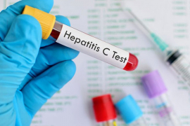Besplatno testiranje na hepatitis B i C