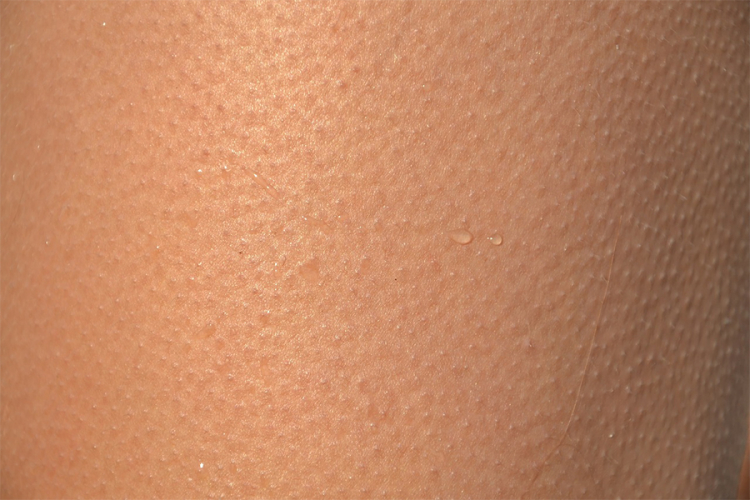 Oružje iz prirode spasava kožu