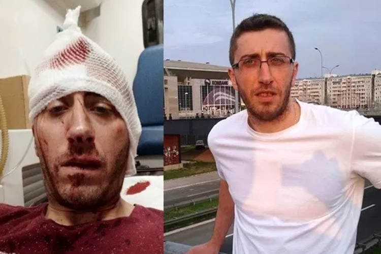 Dokle je stigla istraga o pokušaju ubistva novinara Kovačevića?