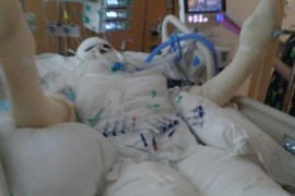 Vapaj doktora i roditelja zbog opasnog izazova: Molimo vas ne palite se