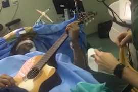 Svirao gitaru dok su mu operisali mozak