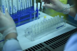 Institut: Nema uslova za proglašenje epidemije gripa