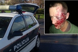 Muškarac brutalno pretučen i opljačkan