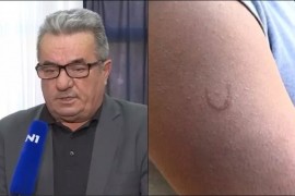 Smjena direktora škole u kojoj je žigosana učenica