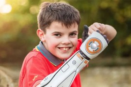 Open Bionics kreira 3D štampane bioničke ruke