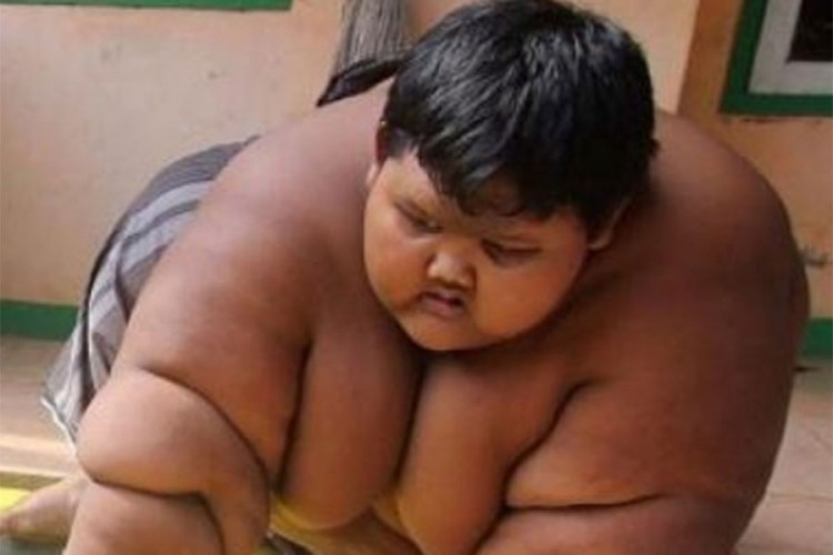 Najdeblji dječak na svijetu smršao 106 kilograma, opet može da se kreće