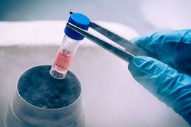 Otvara se prva banka reproduktivnih ćelija u Srbiji