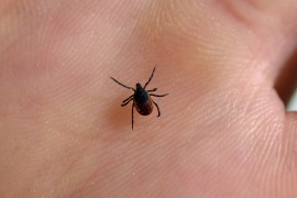 Stručnjaci upozoravaju: Krpelja što prije treba da ukloni stručna ...