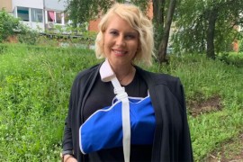 Dea Đurđević skinula dio gipsa sa povrijeđene ruke