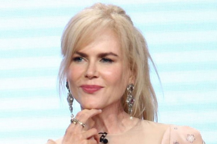 Nikol Kidman se izobličila od botoksa, sad koristi pileću mast