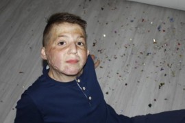 Mali heroj Meho Beton ide u Minhen na tri nove operacije