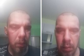 Napadnut Bojan Tomović: Huligani vikali "Udri Turčina"