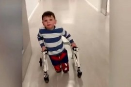 Roditelji brutalno zlostavljali dječaka, doktori mu morali amputirati ...