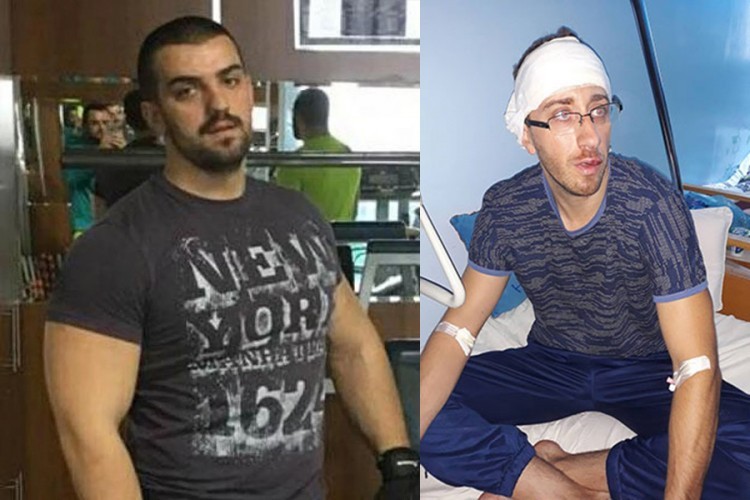 Osumnjičeni za napad na novinara Kovačevića u zatvoru na Tunjicama