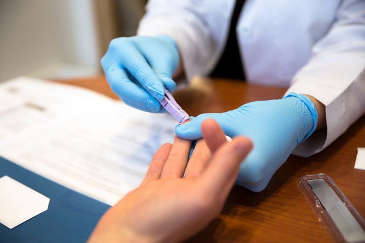 Ispovijest zaraženog mladića: HIV nije kraj života, koristite zaštitu