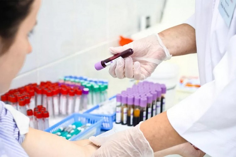 U Srpskoj za godinu dana 10 novooboljelih od HIV/AIDS-a
