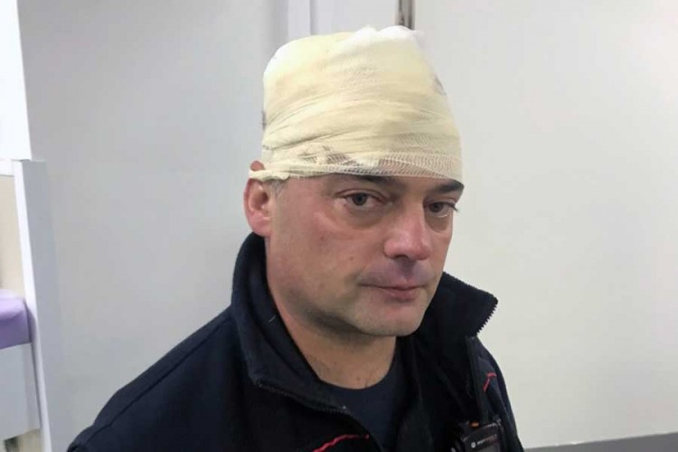 Policija CG: Građani kamenovali policiju, policajac pogođen u glavu