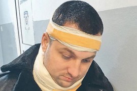 Folk pjevaču gost razbio glavu