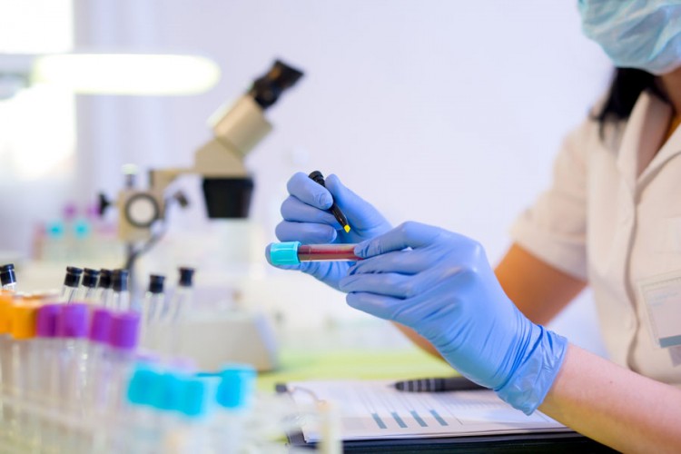 BiH može dijagnostikovati novi koronavirus