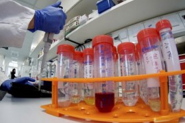 Britanka hospitalozovana u Prištini nema virus korona