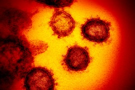Šta virus korona radi ljudskim organima?