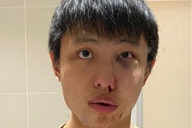 Student iz Azije pretučen u Londonu: Ne želimo tvoj korona virus