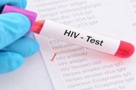 Liječili ga od raka, pa ga izliječili od HIV-a
