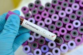 Potvrđen 16. zaraženi u Hrvatskoj, frizer koji je bio u Minhenu