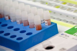 Šest od sedam zaraženih može ostati neotkriveno