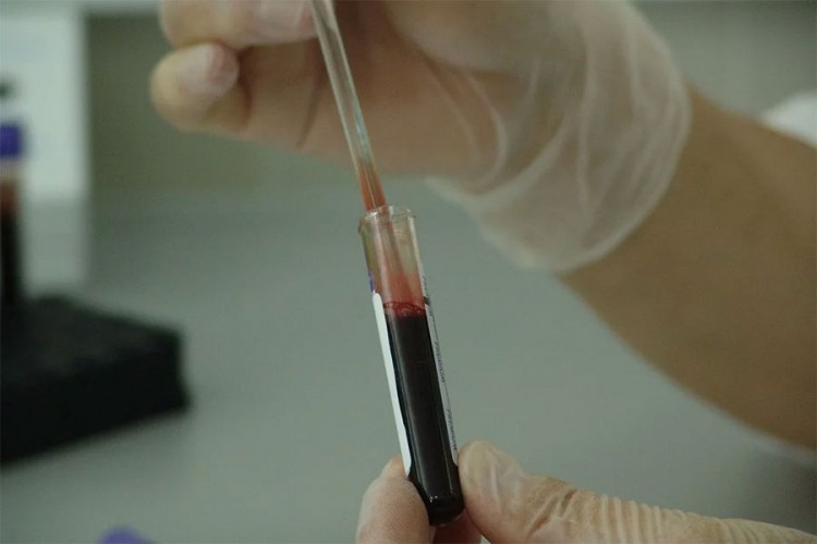 Naredne sedmice u KCUS stiže 150.000 testova na virus korona