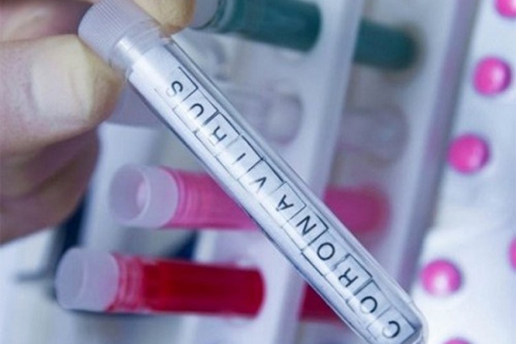 Čerkez: U FBiH od 411 testiranih 48 pozitivno na virus korona