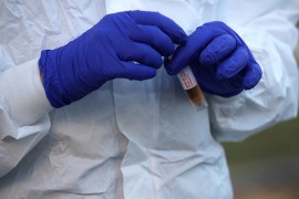 Oporavio se jedini oboljeli od virusa korona iz Dervente