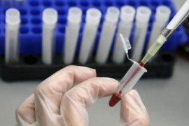 Studija u Holandiji: Oko tri odsto populacije ima antitijela