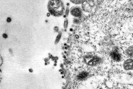 Snimljen tačan trenutak kada virus korona napada stanicu