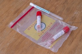 Negativni nalazi svih 20 testiranih u Kozarskoj Dubici