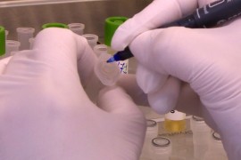 Izolovan virus Kovid-19 u zagrebačkoj klinici za infektivne bolesti
