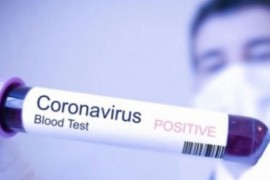 HNK: Na virus pozitivno još pet lica