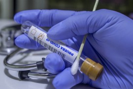 U FBiH još 21 osoba pozitivna na virus korona