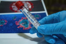 Na KCUS testiran 251 uzorak, jedna osoba pozitivna na virus korona