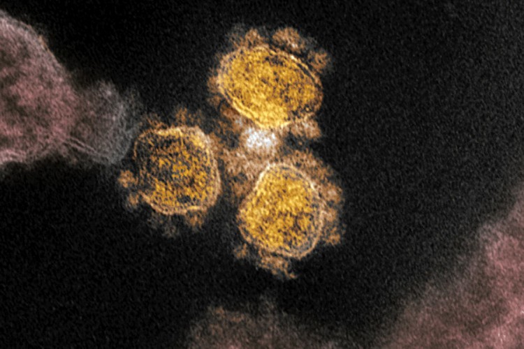 Uskoro test kojim se utvrđuje ko je preležao virus korona