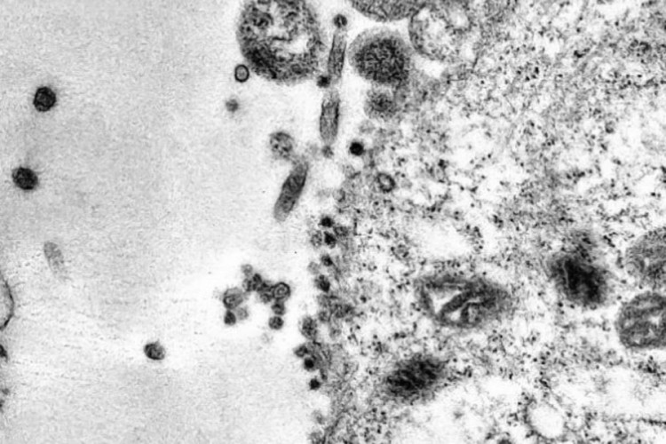 Snimljen tačan trenutak kada virus korona napada stanicu